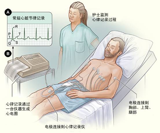 冠心病需要做哪些檢查？(圖1)